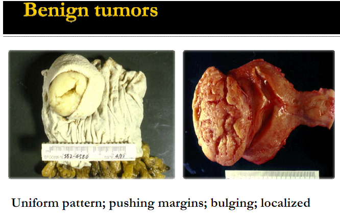 What are malignant tumors?